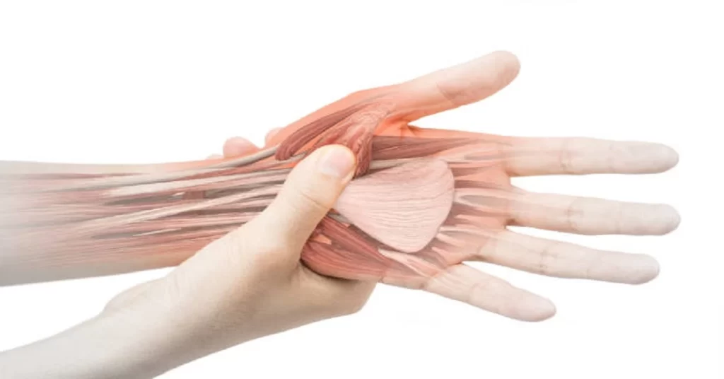 Carpel Tunnel Syndrome - Causes of Fingertips Numbness