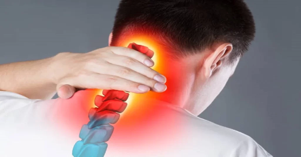 Cervical Radiculopathy - Causes of Fingertips Numbness