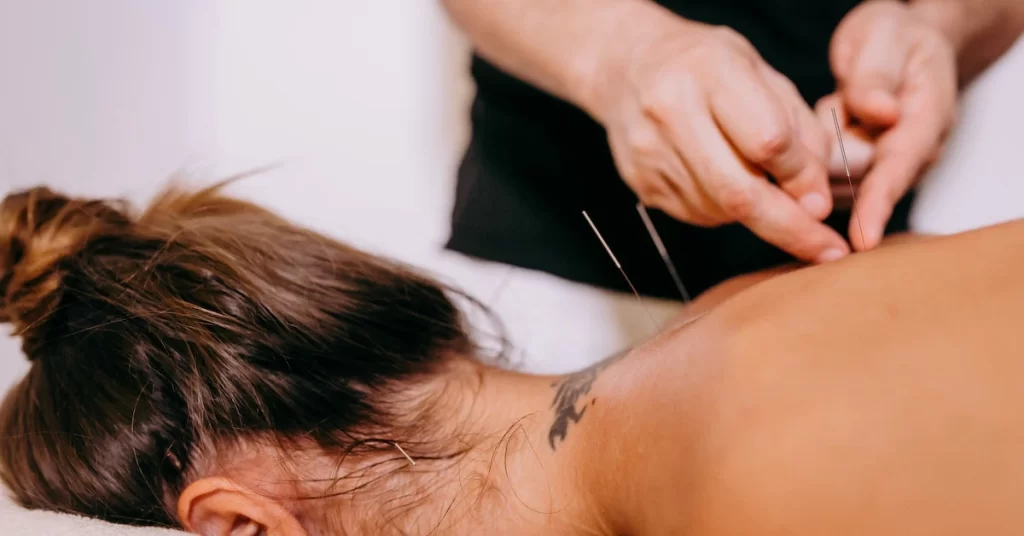 What Amount Would It Be Advisable For Me To Pay For Acupuncture?