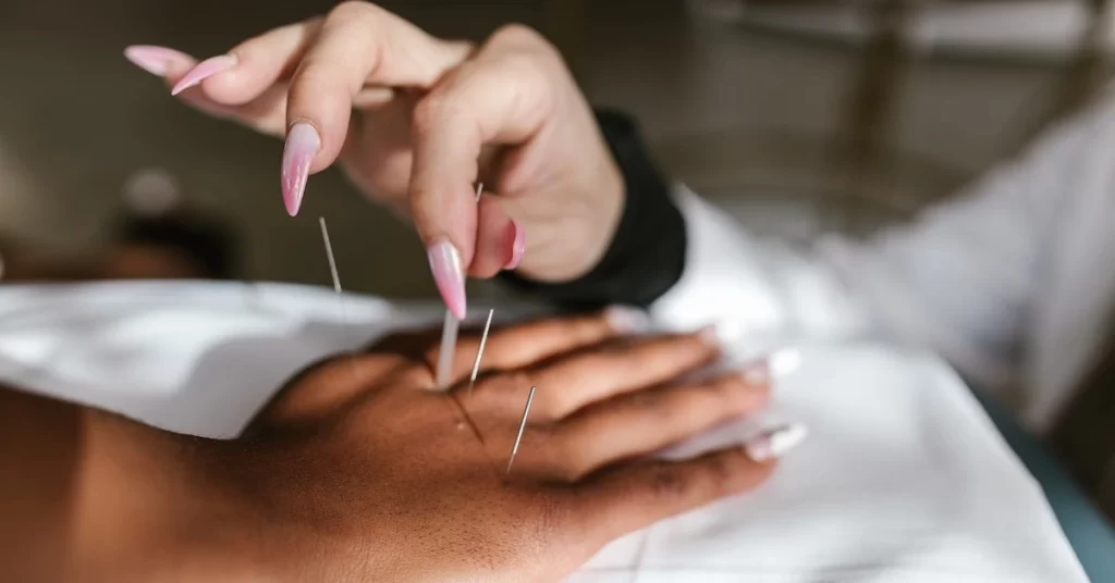 What Should Be Your Decision To Tip Acupuncturist?
